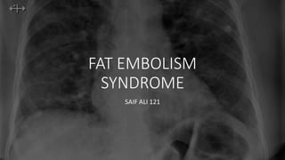FAT EMBOLISM
SYNDROME
SAIF ALI 121
 
