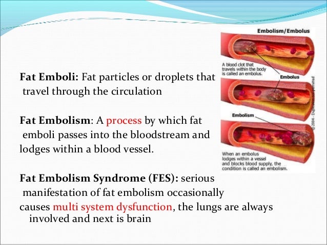 What is an embolism?