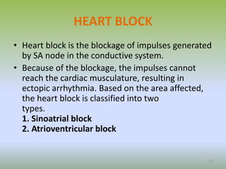 HEART BLOCK
• Heart block is the blockage of impulses generated
by SA node in the conductive system.
• Because of the blockage, the impulses cannot
reach the cardiac musculature, resulting in
ectopic arrhythmia. Based on the area affected,
the heart block is classified into two
types.
1. Sinoatrial block
2. Atrioventricular block
17
 