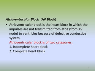 Atrioventricular Block (AV Block)
 Atrioventricular block is the heart block in which the
impulses are not transmitted from atria (from AV
node) to ventricles because of defective conductive
system.
Atrioventricular block is of two categories:
1. Incomplete heart block
2. Complete heart block
19
 