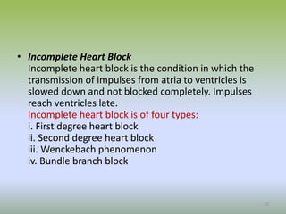 • Incomplete Heart Block
Incomplete heart block is the condition in which the
transmission of impulses from atria to ventricles is
slowed down and not blocked completely. Impulses
reach ventricles late.
Incomplete heart block is of four types:
i. First degree heart block
ii. Second degree heart block
iii. Wenckebach phenomenon
iv. Bundle branch block
20
 