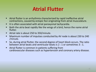 Atrial Flutter
 Atrial ﬂutter is an arrhythmia characterized by rapid ineffective atrial
contractions, caused by ectopic foci originating from atrial musculature.
 It is often associated with atrial paroxysmal tachycardia.
 Both the atria beat rapidly like the wings of a bird, hence the name atrial
ﬂutter.
 Atrial rate is about 250 to 350/minute.
 Maximum number of impulses conducted by AV node is about 230 to 240
/minute.
 So, during atrial ﬂutter, the second degree of heart block occurs. The ratio
between atrial beats and ventricular beats is 2 : 1 or sometimes 3 : 1.
 Atrial ﬂutter is common in patients suffering from
cardiovascular diseases such as hypertension and coronary artery disease.
22
 