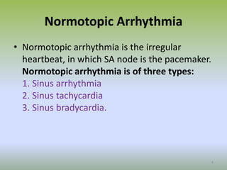 Normotopic Arrhythmia
• Normotopic arrhythmia is the irregular
heartbeat, in which SA node is the pacemaker.
Normotopic arrhythmia is of three types:
1. Sinus arrhythmia
2. Sinus tachycardia
3. Sinus bradycardia.
4
 