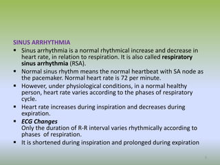 SINUS ARRHYTHMIA
 Sinus arrhythmia is a normal rhythmical increase and decrease in
heart rate, in relation to respiration. It is also called respiratory
sinus arrhythmia (RSA).
 Normal sinus rhythm means the normal heartbeat with SA node as
the pacemaker. Normal heart rate is 72 per minute.
 However, under physiological conditions, in a normal healthy
person, heart rate varies according to the phases of respiratory
cycle.
 Heart rate increases during inspiration and decreases during
expiration.
 ECG Changes
5
Only the duration of R-R interval varies rhythmically according to
phases of respiration.
 It is shortened during inspiration and prolonged during expiration
 