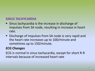 SINUS TACHYCARDIA
 Sinus tachycardia is the increase in discharge of
impulses from SA node, resulting in increase in heart
rate.
 Discharge of impulses from SA node is very rapid and
the heart rate increases up to 100/minute and
sometimes up to 150/minute.
ECG Changes
ECG is normal in sinus tachycardia, except for short R-R
intervals because of increased heart rate
8
 