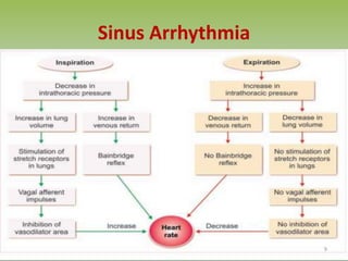 Sinus Arrhythmia
9
 