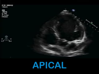 APICAL
 