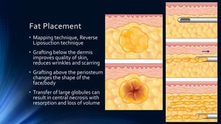 Fat Placement
• Mapping technique, Reverse
Liposuction technique
• Grafting below the dermis
improves quality of skin,
reduces wrinkles and scarring
• Grafting above the periosteum
changes the shape of the
face/body
• Transfer of large globules can
result in central necrosis with
resorption and loss of volume
 