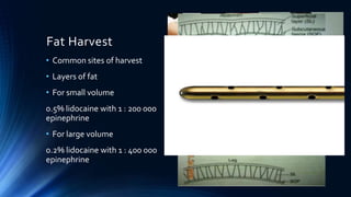 Fat Harvest
• Common sites of harvest
• Layers of fat
• For small volume
0.5% lidocaine with 1 : 200 000
epinephrine
• For large volume
0.2% lidocaine with 1 : 400 000
epinephrine
 