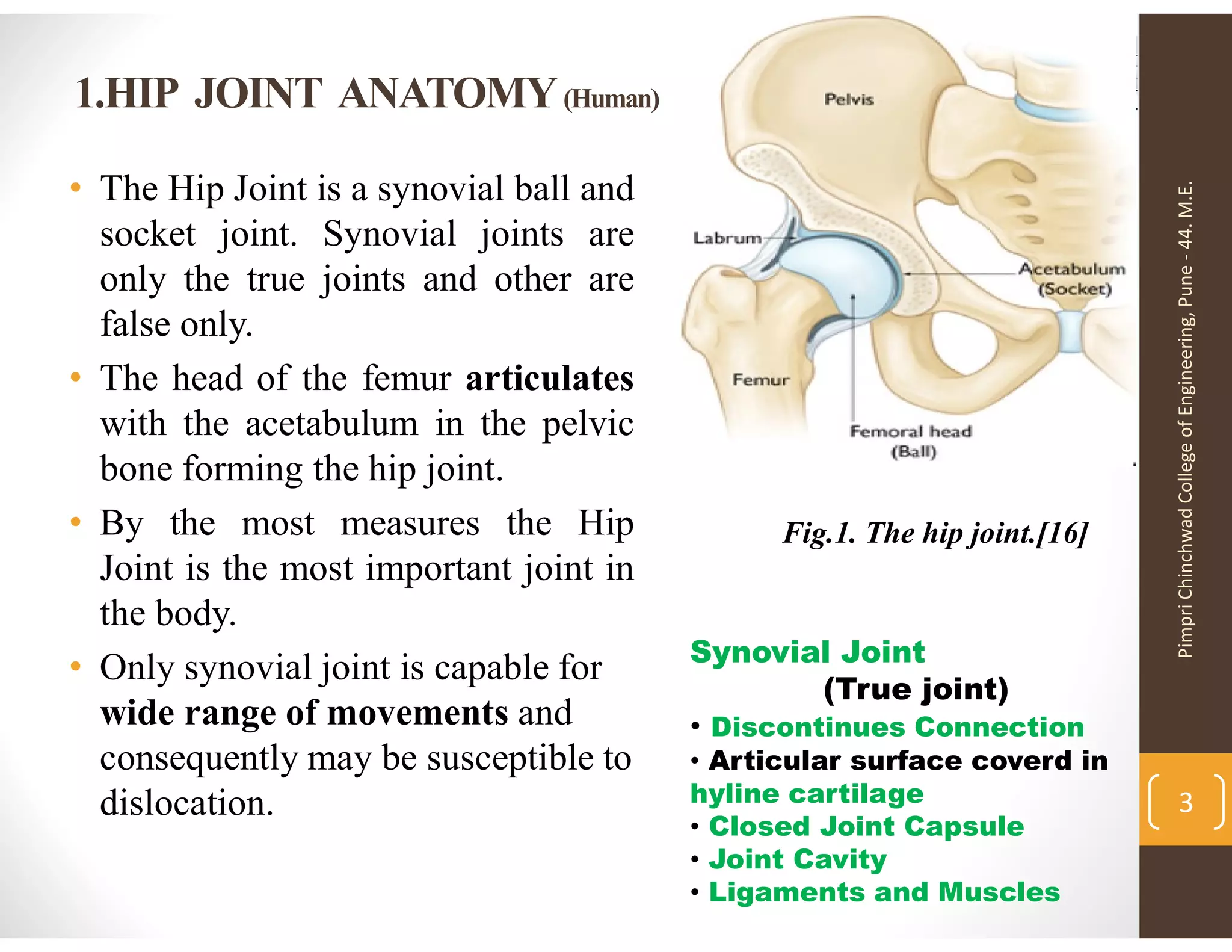 Fatigue life estimation of Human artificial hip joint based on modeling ...