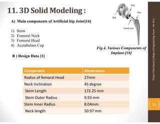 Fatigue life estimation of Human artificial hip joint based on modeling ...