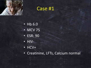 Case #1
• Hb 6.0
• MCV 75
• ESR: 90
• HIV-
• HCV+
• Creatinine, LFTs, Calcium normal
 