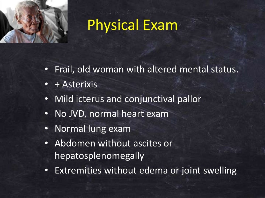 Fatigue, weakness & weight loss