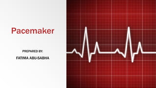Pacemaker
PREPARED BY:
FATIMA ABU-SABHA
 
