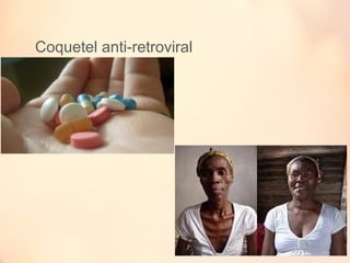 Coquetel anti-retroviral
 