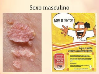 Sexo masculino
Sexo masculino
 
