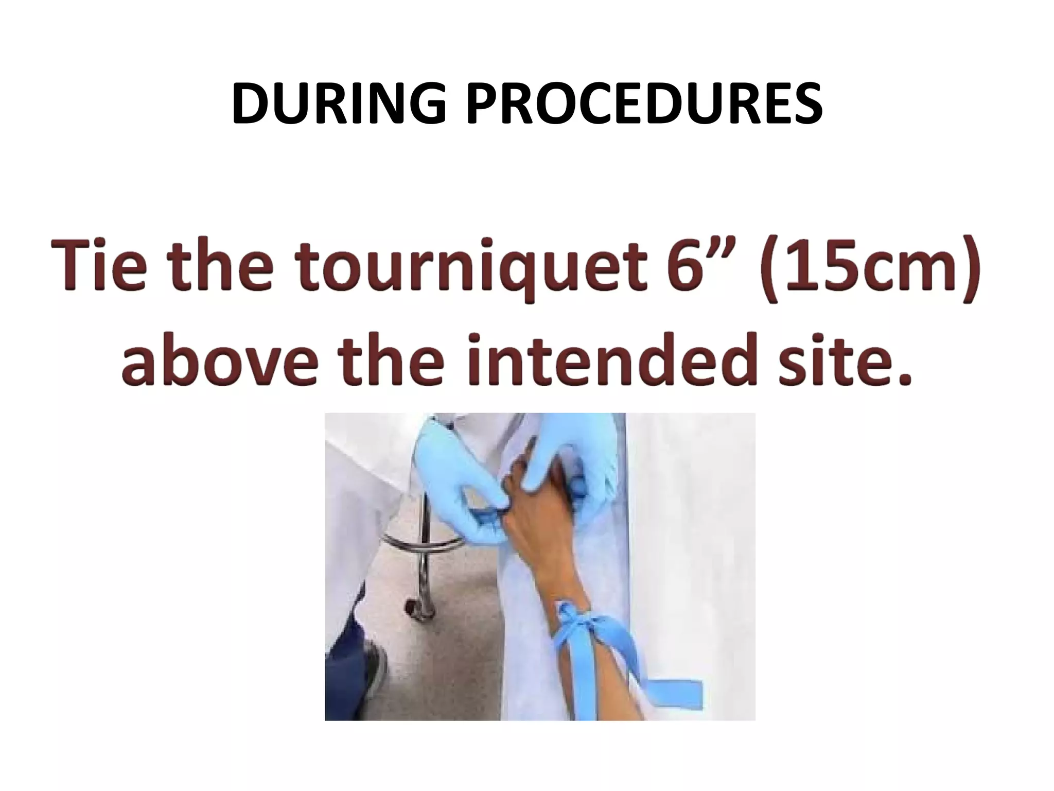 DURING PROCEDURES