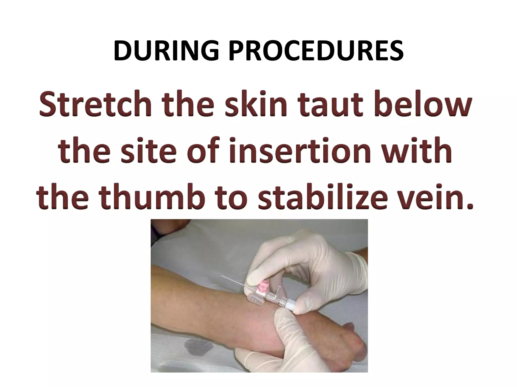 DURING PROCEDURES