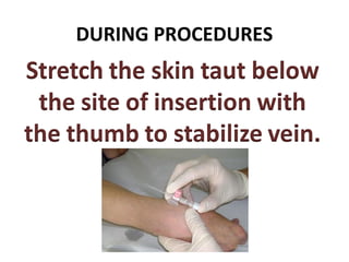 DURING PROCEDURES
 