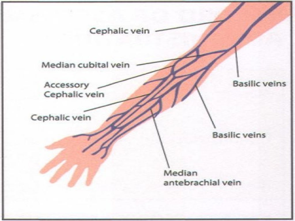 Intravenous Cannulation