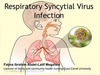 Respiratory Syncytial Virus
Infection
Fatma Ibrahim Abdel-Latif Megahed
Lecturer of family and community health nursing-Suez Canal University
 