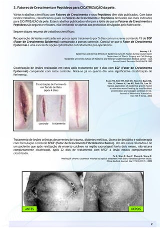 3. Fatores de Crescimento e Peptídeos para CICATRIZAÇÃO da pele.
Vários trabalhos científicos com e seus Peptídeos têm sido publicados. Com base
nestes trabalhos, classificamos quais os Fatores de Crescimento e Peptídeos derivados são mais indicados
para CICATRIZAÇÃO da pele. Estes trabalhos publicados reforçam a idéia de que os Fatores de Crescimento e
Peptídeos são seguros e eficazes, não limitando-se apenas aos protocolos divulgados pelo fabricante.
Seguem alguns resumos de trabalhos científicos:
Recuperação de lesões realizadas em porcos após tratamento por 5 dias com um creme contendo 1% de EGF
(Fator de Crescimento Epidermal) comparado a porcos controle. Conclui-se que o Fator de Crescimento
Epidermal é uma excelente opção epitelizante no tratamento pós-operatório.
Nanney L.B.
Epidermal and Dermal Effects of Epidermal Growth Factor during wound repair
Department of Plastic Surgery and Cell Biology
Vanderbilt University School of Medicine and Veteran’s Administration Medical Center – USA
Journal Invest Dermatol 94:624-629-1990
Cicatrização de lesões realizadas em ratos após tratamento por 4 dias com EGF (Fator de Crescimento
Epidermal) comparado com ratos controle. Nota-se já no quarto dia uma significativa cicatrização do
ferimento.
Kwon YB, Kim HW, Roh DH, Yoon SY, Baek RM,
Kim JY, Kweon H, Lee KG, Park YH, Lee JH.
Topical application of epidermal growth factor
accelerates wound healing by myofibroblast
proliferation and collagen synthesis in rat.
Journal of Veterinary ScienceJun;
7(2):105-9 Korea. 2006
Tratamento de lesões crônicas decorrentes de trauma, diabetes mellitus, úlcera de decúbito e radioterapia
com formulação contendo bFGF (Fator de Crescimento Fibroblástico Básico). Um dos casos relatados é de
um paciente que após realização de enxerto cutâneo na região sacroxigeal havia dois meses, não estava
completamente cicatrizado. Após 22 dias de tratamento com bFGF a lesão estava completamente
cicatrizada.
Fu X, Shen Z, Guo Z, Zhang M, Sheng Z.
Healing of chronic cutaneous wounds by topical treatment with basic fibroblast growth factor.
China Medical Journal Mar;115(3):331-5 - 2002
Fatores de Crescimento
Cicatrização de Ferimento
em Tecido de Rato
(após 4 dias)
controle tratamento
2
ANTES DEPOIS
 