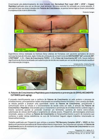 Experiência clínica realizada no Instituto Dona Libânea de Fortaleza com paciente portadora de úlcera
varicosa há mais de três anos.Após 14 dias de utilização de um Gel Creme de HOSTACERIN SAF contendo IDP-
®
2 PEPTIDEO - 2,5% + Fator de Crescimento TGFβ3 - 2,5% e Fator de Crescimento IGF 2,0%, houve melhora
significativa da úlcera localizada com substituição do tecido necrosado por um tecido de granulação saudável
sem intervenção cirúrgica.
Cortesia da Dra. Cristina Facundo
Farmacêutica da Farmácia Prophórmula de Fortaleza – CE
4. Fatores de Crescimento e Peptídeos para tratamento e prevenção do ENVELHECIMENTO
CUTÂNEO (anti-aging).
É provado cientificamente que a carência de Fatores de Crescimento na pele acelera o processo de
envelhecimento, principalmente razões relacionadas ao envelhecimento intrínseco. Com o avanço da idade,
as células passam a produzir uma quantidade menor de Fatores de Crescimento, prejudicando a
comunicação entre as células e o funcionamento do tecido como um todo. A seleção dos Fatores de
Crescimento e Peptídeos relacionados para o tratamento e prevenção do envelhecimento cutâneo segue o
mesmo raciocínio quando se pretende cicatrizar um ferimento: aumento de matriz extra-celular,
substituição de células danificadas e surgimento de células jovens. Fitzpatrick, dermatologista americano
renomado, passou a utilizar os Fatores de Crescimento no fotoenvelhecimento a partir do momento que
conheceu o poder destas substâncias na cura de ferimentos! Seguem alguns trabalhos relacionados ao
fotoenvelhecimento:
Trabalho publicado por Fitzpatrick que utilizou o produto TNS Recovery Complex (bFGF + VEGF) da Skin
Medica em pacientes portadoras de fotoenvelhecimento importante. Seu interesse por estudar os Fatores de
Crescimento partiu do momento em que se deparou com o desempenho dos Fatores de Crescimento na cura
de ferimentos crônicos.
Fitzpatrick, R. E., Mehta, R. C.
Endogenous growth factor as cosmeceutical
Dermatologic Therapy, Vol. 20, 350-359 – 2007
®
ANTES ANTES
Tratamento com:
®
EGF + bFGF + Copper Peptídeo PLACEBO
Cicatrização pós-abdominoplastia de área tratada com Dermaheal Post Laser (EGF + bFGF + Copper
Peptídeo) aplicada uma vez ao dia por duas semanas. Na área controle foi utilizado um creme placebo. É
perceptível que nas áreas tratadas com Fatores de Crescimento, os pontos hemorrágicos foram controlados
e a espessura da cicatriz diminuída.
Protocolo Caregen
3
ANTES DEPOIS
 