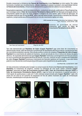 Estudos comprovam a influência dos Fatores de Crescimento e seus Peptídeos no ciclo capilar. Por razões
hormonais e também por envelhecimento, células responsáveis passam a produzir uma quantidade inferior
de Fatores de Crescimento, influenciando diretamente a quantidade de cabelos no couro cabeludo.
Pesquisadores japoneses, da Universidade de Kyoto, conduziram um estudo, publicado no Tissue Engineering,
que investigou como o Fator de Crescimento Fibroblástico Básico (bFGF) de liberação prolongada afeta o
crescimento capilar de ratos nas fases anágena e telógena do ciclo capilar, após 10 dias de aplicação. Os
resultados mostram que 70 mcg de bFGF, após o período determinado, aumentaram o tamanho dos folículos
capilares, comprovando seus efeitos positivos no ciclo do crescimento capilar em ratos.
bFGF promotes the increase of the size of hair follicles in 10 Days
Japan. Tissue Eng. Jul;8(3):359-66 - 2002
®
Tem sido demonstrado que Peptídeos de Cobre (Copper Peptídeo ) age como fator de crescimento na
diferenciação celular, além de estimular a proliferação de fibroblastos dérmicos e elevar a produção de fator
de crescimento endotelial vascular. Este estudo avaliou o efeito do complexo Tripeptídeo de Cobre (Copper
®
Peptídeo ) no crescimento de cabelo em humanos, através de estudo ex vivo e cultura de células da papila
®
dérmica. Os resultados demonstraram que Copper Peptídeo estimulou o prolongamento de folículos pilosos
ex vivo e a proliferação das papilas dérmicas do folículo. Com isso, concluiu-se que o complexo de tripeptídeo
®
de cobre (Copper Peptídeo ) promoveu crescimento de folículos capilares em humanos, e que este efeito
pode ter ocorrido devido à estimulação da proliferação e pelo impedimento da queda capilar.
Arch Pharm Res. Jul;30(7):834-9. 2007
Um dos protocolos realizados pela Caregen na comprovação de eficácia dos Fatores de Crescimento e seus
Peptídeos no tratamento da alopécia, consiste na utilização de uma loção capilar contendo Copper
®
Peptideo associado de Fator de Crescimento Insulínico (IGF), Fator de Crescimento Vascular (VEGF) e
Fator de Crescimento Fibroblástico Básico (bFGF). Logo no início do tratamento é possível perceber a
®
interrupção da queda graças a ação anti 5 alfa redutase proporcionada pelo Copper Peptídeo . Após três
meses de uso nota-se um aumento da população de fios de cabelo resultado das ações de revitalização
folicular, vasodilatação e nutrição dos novos fios.
Aumento da quantidade de células
endoteliais após adição do Fator de
Crescimento Fibroblástico Ácido (aFGF).
A B
Sem Fator de Crescimento 25ng/mL de aFGF
6
 