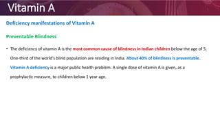 Vitamin A
Deficiency manifestations of Vitamin A
Preventable Blindness
• The deficiency of vitamin A is the most common cause of blindness in Indian children below the age of 5.
One-third of the world's blind population are residing in India. About 40% of blindness is preventable.
Vitamin A deficiency is a major public health problem. A single dose of vitamin A is given, as a
prophylactic measure, to children below 1 year age.
 