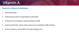 Vitamin A
Causes for Vitamin A Deficiency
1. Decreased intake
2. Obstructive jaundice causing defective absorption
3. Cirrhosis of liver leading to reduced synthesis of RBP
4. Severe malnutrition, where amino acids are not available for RBP synthesis
5. Chronic nephrosis, where RBP is excreted through urine.
 