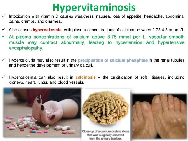 Fat soluble vitamins- structure, rda, functions, sources, deficiency,…