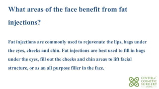 Fat Transfer (Fat Grafting) to the Face