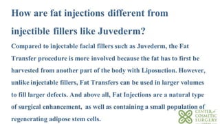 Fat Transfer (Fat Grafting) to the Face