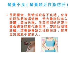 營養不良 ( 營養缺乏性脂肪肝 )   長期厭食、飢餓或吸收不良時，全身的脂肪將被逼燃燒，使大量脂肪進入肝臟，等待代謝。但因長期缺乏蛋白質會導致脂質代謝異常，使脂肪囤積肝臟。這種營養缺乏性脂肪肝，較常見於減肥不當的人。  