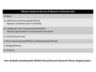 Fibrosis: based on the use of Masson’s trichrome stain
0: None
1a: Mild zone 3 perisinusoidal fibrosis
    Requires trichrome stain to identify

1b: Moderate zone 3 perisinusoidal fibrosis
   May be appreciated on haemotoxylin and eosin

1c: Portal fibrosis only
2: Zone 3 perisinusoidal fibrosis andd periportal fibrosis
3: Bridging fibrosis
4: Cirrhosis



Non-alcoholic steatohepatitis (NASH) Clinical Research Network Fibrosis Staging System
 