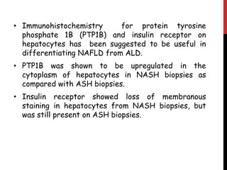 • Immunohistochemistry      for protein tyrosine
  phosphate 1B (PTP1B) and insulin receptor on
  hepatocytes has been suggested to be useful in
  differentiating NAFLD from ALD.
• PTP1B was shown to be upregulated in the
  cytoplasm of hepatocytes in NASH biopsies as
  compared with ASH biopsies.
• Insulin receptor showed loss of membranous
  staining in hepatocytes from NASH biopsies, but
  was still present on ASH biopsies.
 