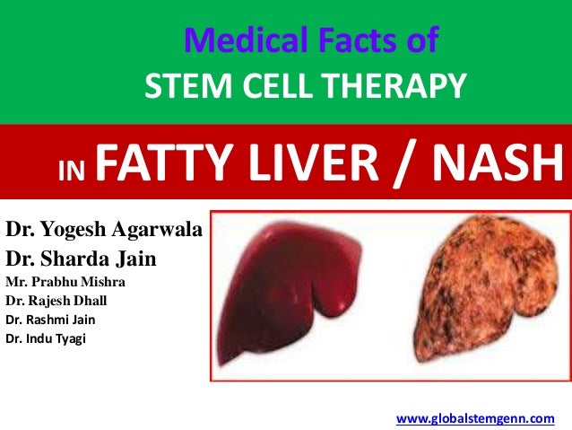Natural Treatment For Nash Natural Treatment For Nash