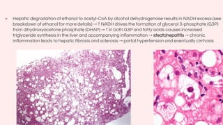 Fatty liver: approach to fatty liver and management | PDF