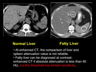 Normal Liver Fatty Liver At enhanced CT, the comparison of liver and spleen attenuation value is not reliable. Fatty liver can be diagnosed at contrast-enhanced CT if absolute attenuation is less than 40 HU,  but this threshold has limited sensitivity . 