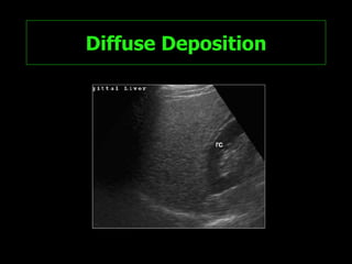 Diffuse Deposition 