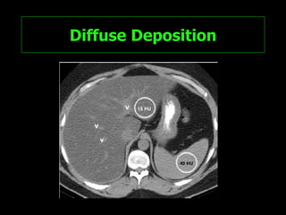 Diffuse Deposition 