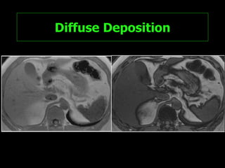Diffuse Deposition 
