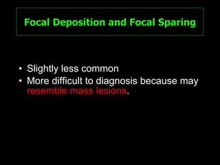 Focal Deposition and Focal Sparing Slightly less common More difficult to diagnosis because may  resemble mass lesions . 