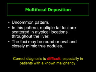 Multifocal Deposition Uncommon pattern. In this pattern, multiple fat foci are scattered in atypical locations throughout the liver.  The foci may be round or oval and closely mimic true nodules.  Correct diagnosis is  difficult , especially in patients with a known malignancy . 