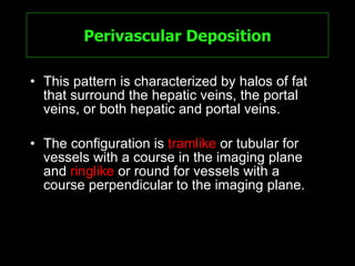 Perivascular Deposition This pattern is characterized by halos of fat that surround the hepatic veins, the portal veins, or both hepatic and portal veins.  The configuration is  tramlike  or tubular for vessels with a course in the imaging plane and  ringlike  or round for vessels with a course perpendicular to the imaging plane.  