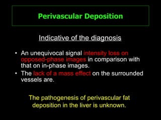 Perivascular Deposition An unequivocal signal  intensity loss on opposed-phase images  in comparison with that on in-phase images. The  lack of a mass effect  on the surrounded vessels are.  Indicative of the diagnosis The pathogenesis of perivascular fat deposition in the liver is unknown. 