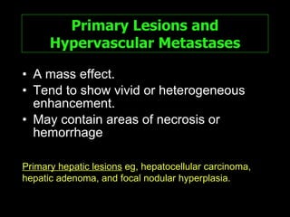 Primary Lesions and Hypervascular Metastases A mass effect. Tend to show vivid or heterogeneous enhancement. May contain areas of necrosis or hemorrhage Primary hepatic lesions  eg, hepatocellular carcinoma, hepatic adenoma, and focal nodular hyperplasia. 