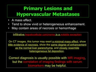 Primary Lesions and Hypervascular Metastases A mass effect. Tend to show vivid or heterogeneous enhancement. May contain areas of necrosis or hemorrhage Infiltrative  hepatocellular carcinoma  is a  notable exception On CT images, this tumor may exert  a minimal mass effect , show  little evidence of necrosis , show the  same degree of enhancement as the normal liver parenchyma , and  closely resemble heterogeneous fat deposition .  Correct diagnosis is usually possible with  MR imaging , but the  correlation of imaging findings with serum biomarkers  may be helpful. 