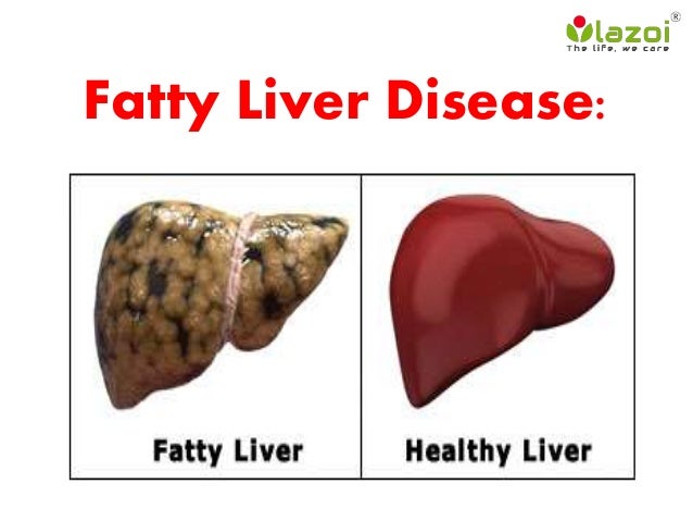 Natural Remedies For Healing The Liver Natural Remedies For Healing The Liver