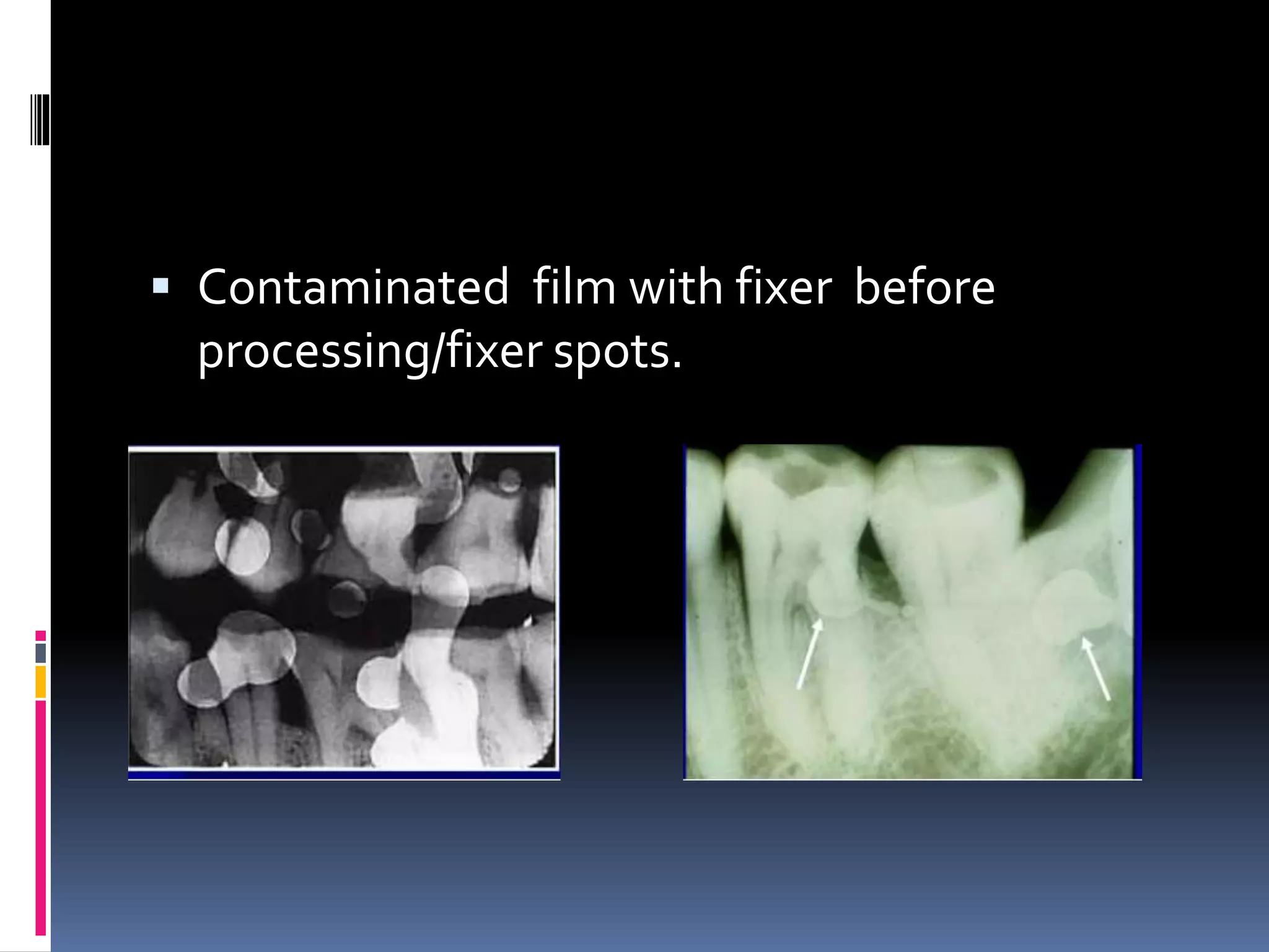 Faulty radiographs | PPTX